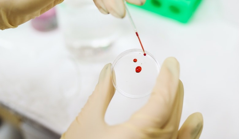 How do blood tests work?
