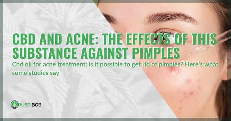 The effects of CBD against acne